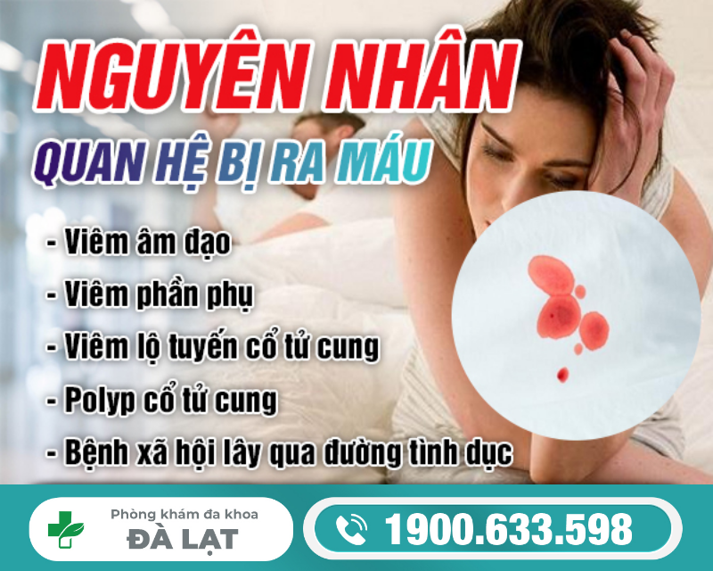 Hình ảnh minh họa